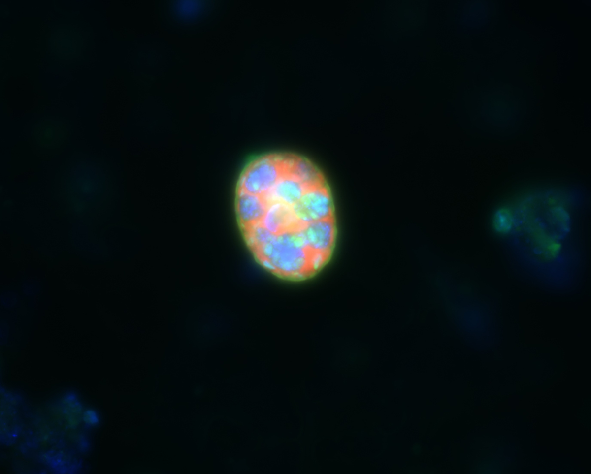 FISH picture of a ciliate with denitrifying endosymbionts