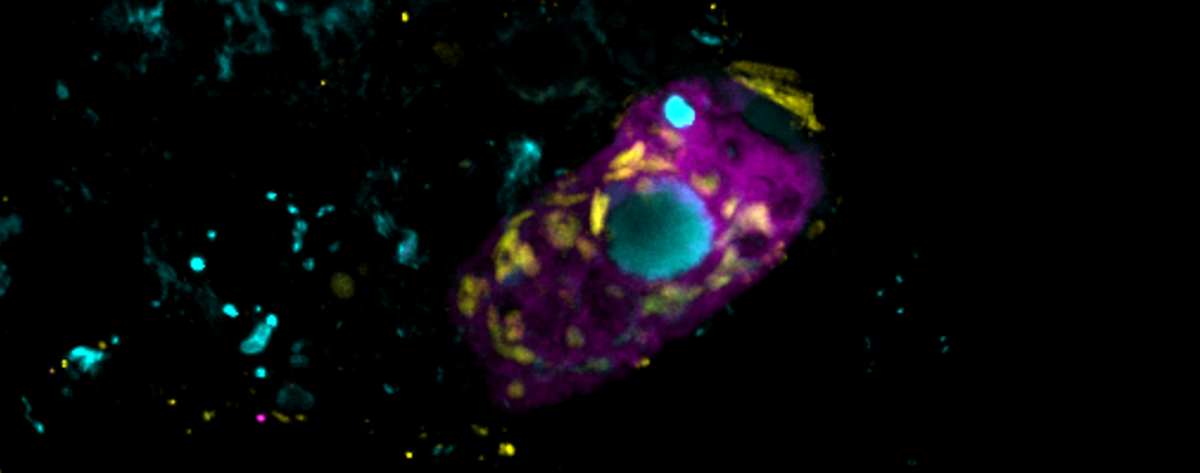 the ciliate under the microscope