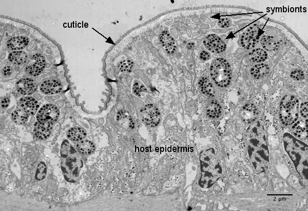 TEM Olavius epidermis